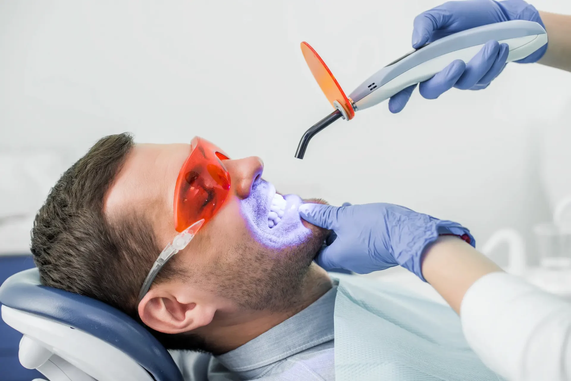 Bleaching Procedure for Teeth Whitening Farmington Hills MI