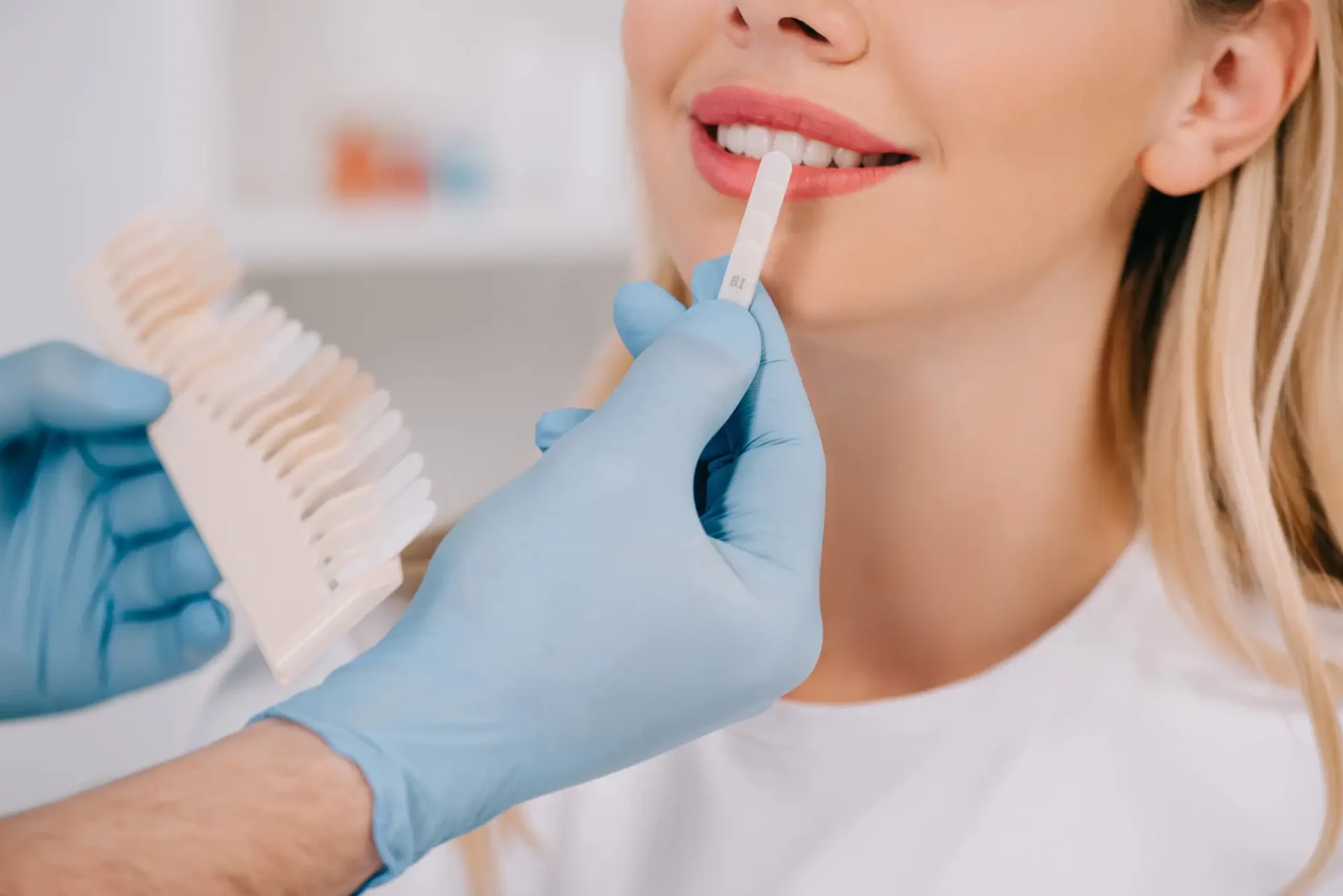 Teeth Shade Matching for Teeth Whitening Farmington Hills MI