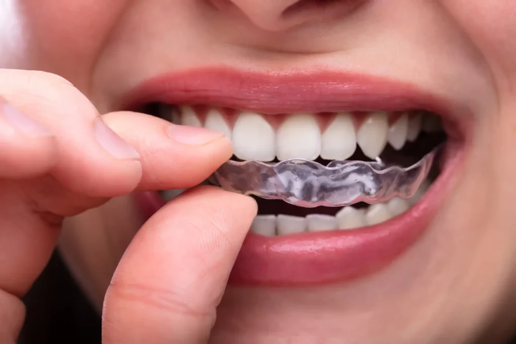 Woman Using Clear Aligners Farmington