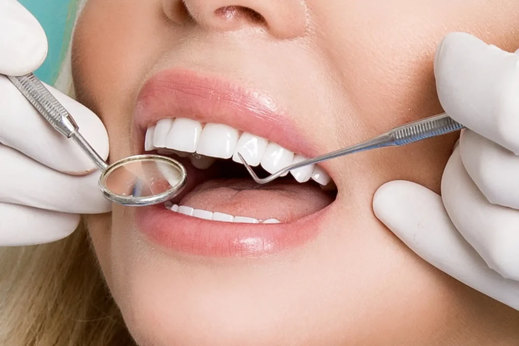 Beautiful Smile with Lumineers® in Farmington Hills